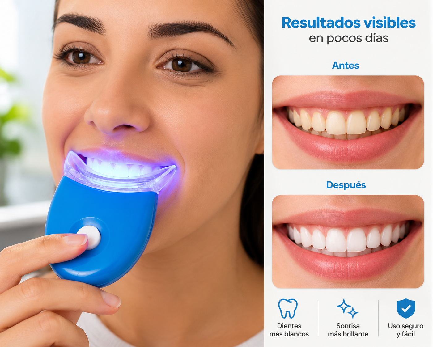 Blanqueador dental de Luz UV